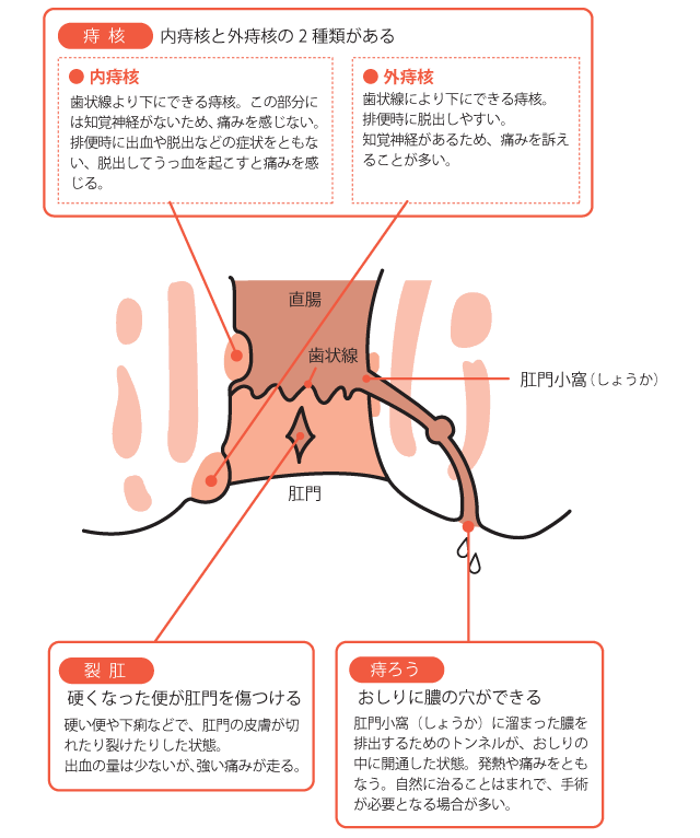 痛い 生理 前 おしり が